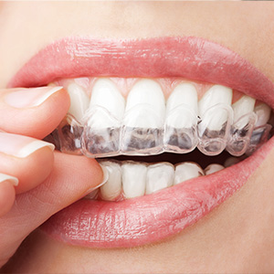 Family Dentist in Citrus Park